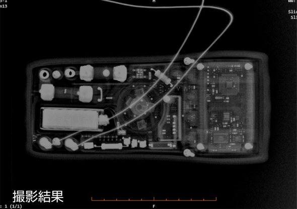 X線管